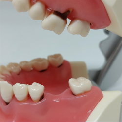 Model til trning af parodontale behandlingsteknikker 